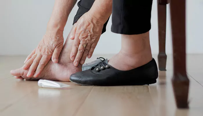 Expert Tips To Get Rid Of Swollen Leg Pain